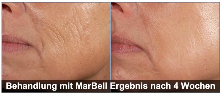 MarBell - Active Skin Serum | Anti Aging - Image 2
